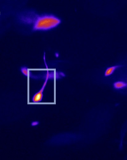 The same field of pig sperm cells with the correction on