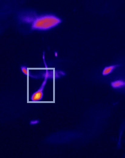A field of pig sperm cells in a light-sheet microscope without adaptive optics; a box marks the cell shown at magnification