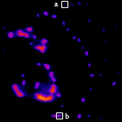Fluorescent microspheres imaged under a mismatched immersion, uncorrected: the beads blur into dim, haloed blobs