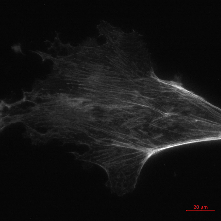 The same fluorocells after PHI corrected the induced spherical aberration