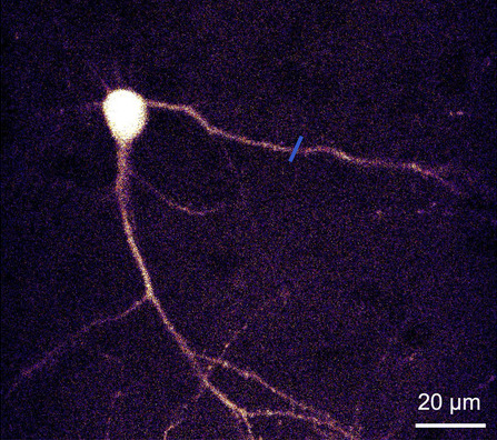The same neuron with the correction applied: more dendrites are visible and the spines along them resolve