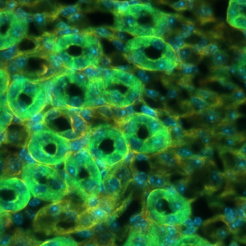 The same kidney field after PHI corrected the aberrations the tissue introduces: nuclei separate into individual bodies and the tubule walls come up crisp