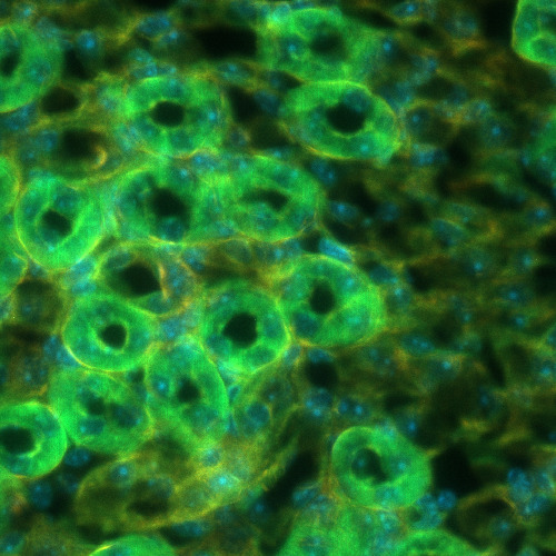 Kidney slice under the system correction alone, with the aberrations the tissue introduces left uncorrected: nuclei blur together and the tubule walls are veiled