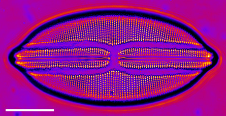 Navicula lyra diatom imaged in a single focal plane: the pore rows are only partly resolved