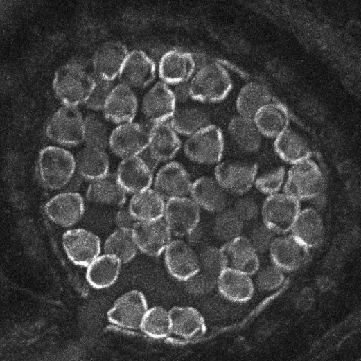 The same pollen grain without adaptive optics