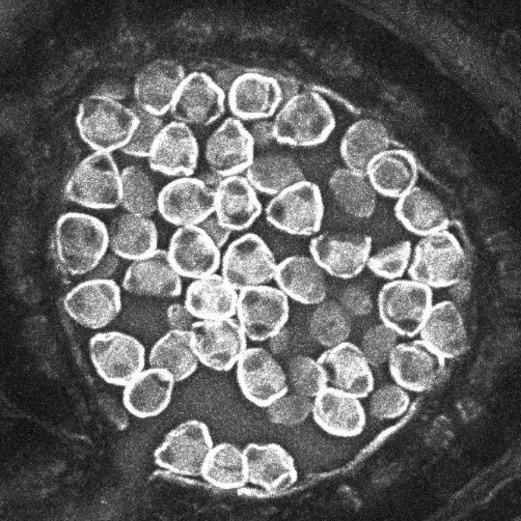 Pollen grain imaged with two-photon excitation, with Phinden’s correction